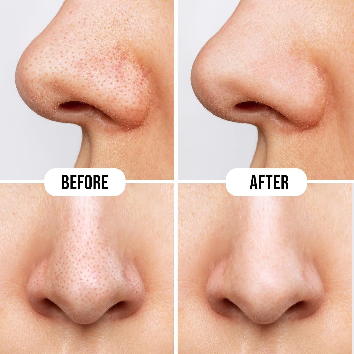 Hilary Rhoda Rose Deep Cleanse Nose Strips 10 PIECE