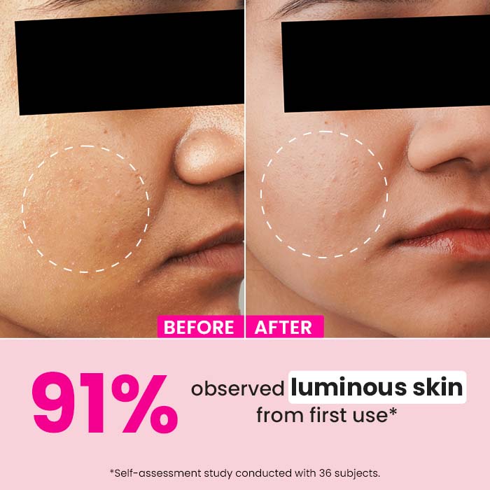 Watermelon +10% Glycolic Gentle Exfoliating Face Serum