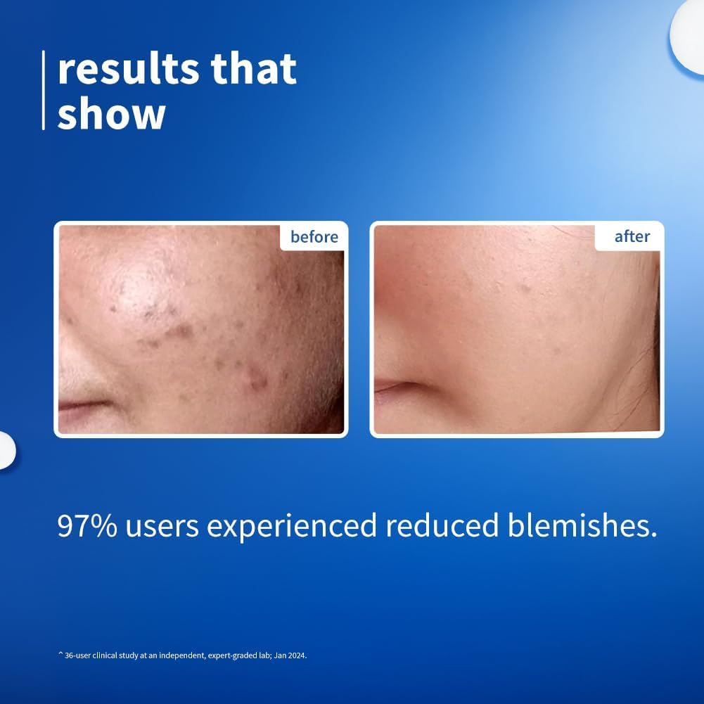 Plum 10% Niacinamide & Rice Water Serum 30 MILLI_LITRE