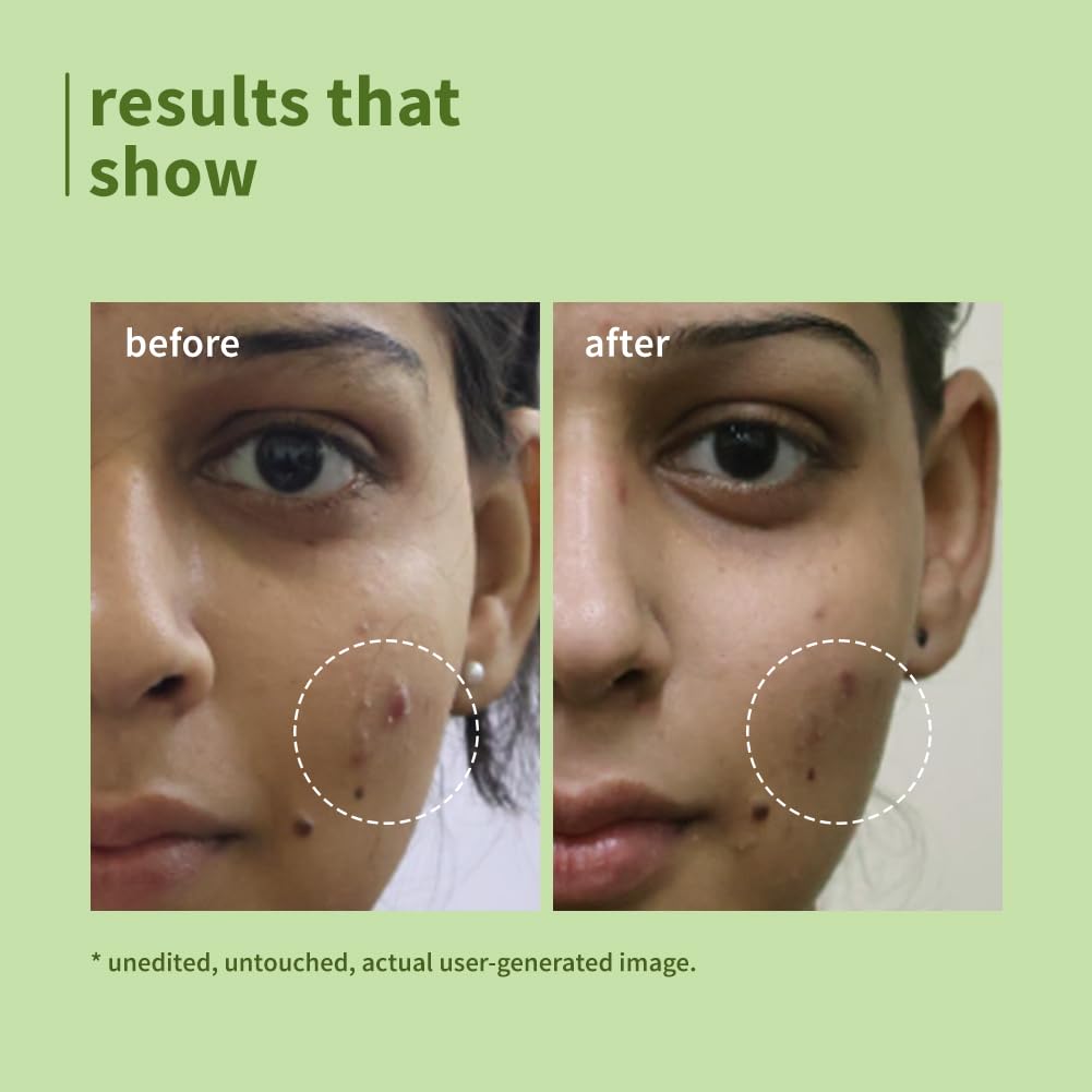 Plum Green Tea Pore Cleansing Face Wash 100 MILLI_LITRE