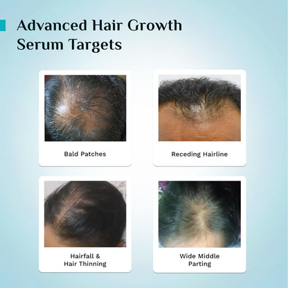 Pilgrim Redensyl & Anagain Advanced Hair Growth Serum 50 MILLI_LITRE