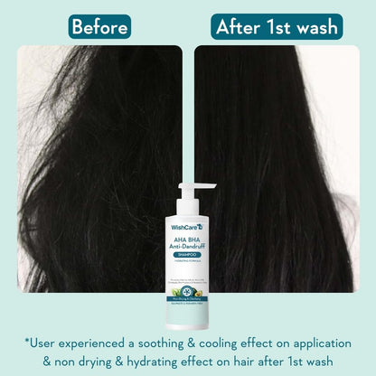 WISHCARE Hydrating AHA BHA Anti Dandruff Shampoo 250ml