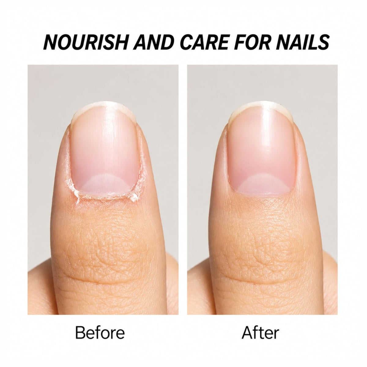 SHILLS PROFESSIONAL CUTICLE SOFTENER