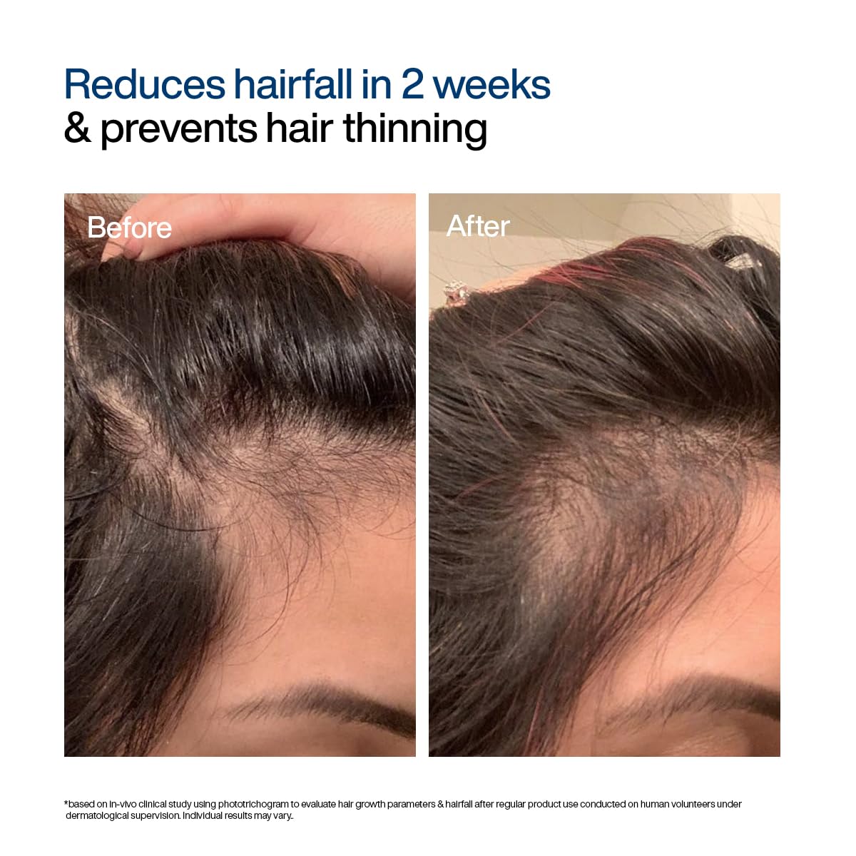 Wishcare Concentrate Hair Growth Serum 20 ml