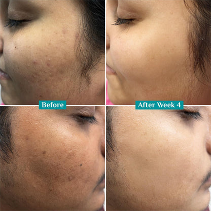 Pilgrim 10% Vitamin C Face Serum 30 MILLI_LITRE