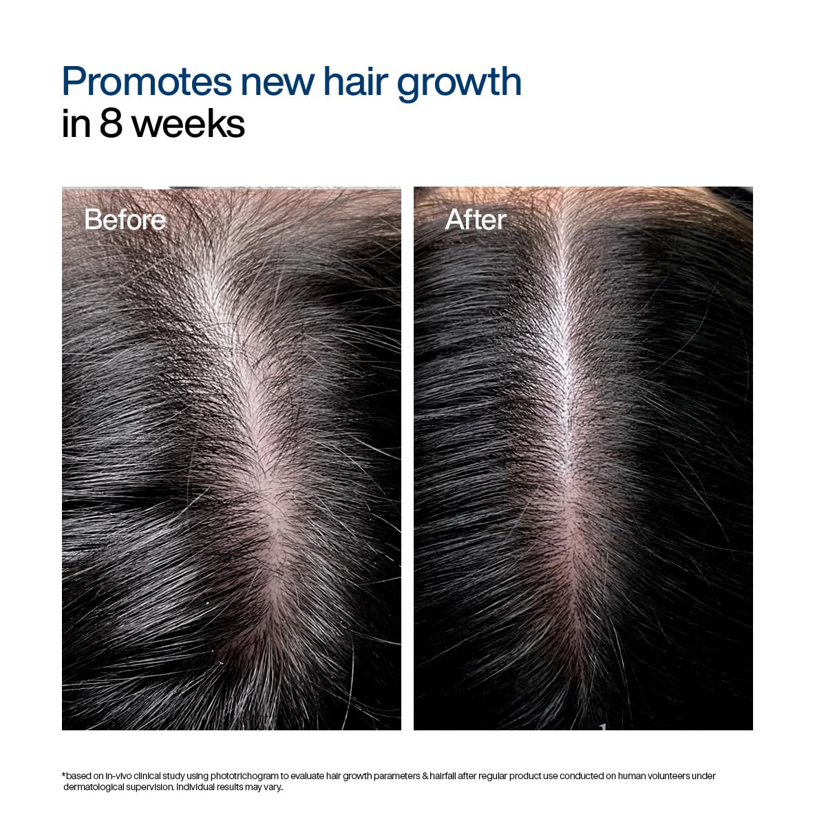 Wishcare Concentrate Hair Growth Serum 20 ml