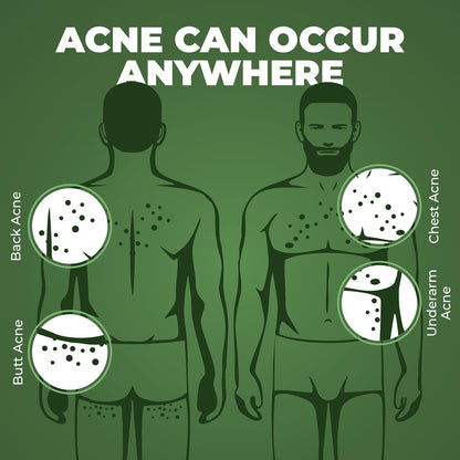 Beardo B- Acne Clear Body Wash 200 ml