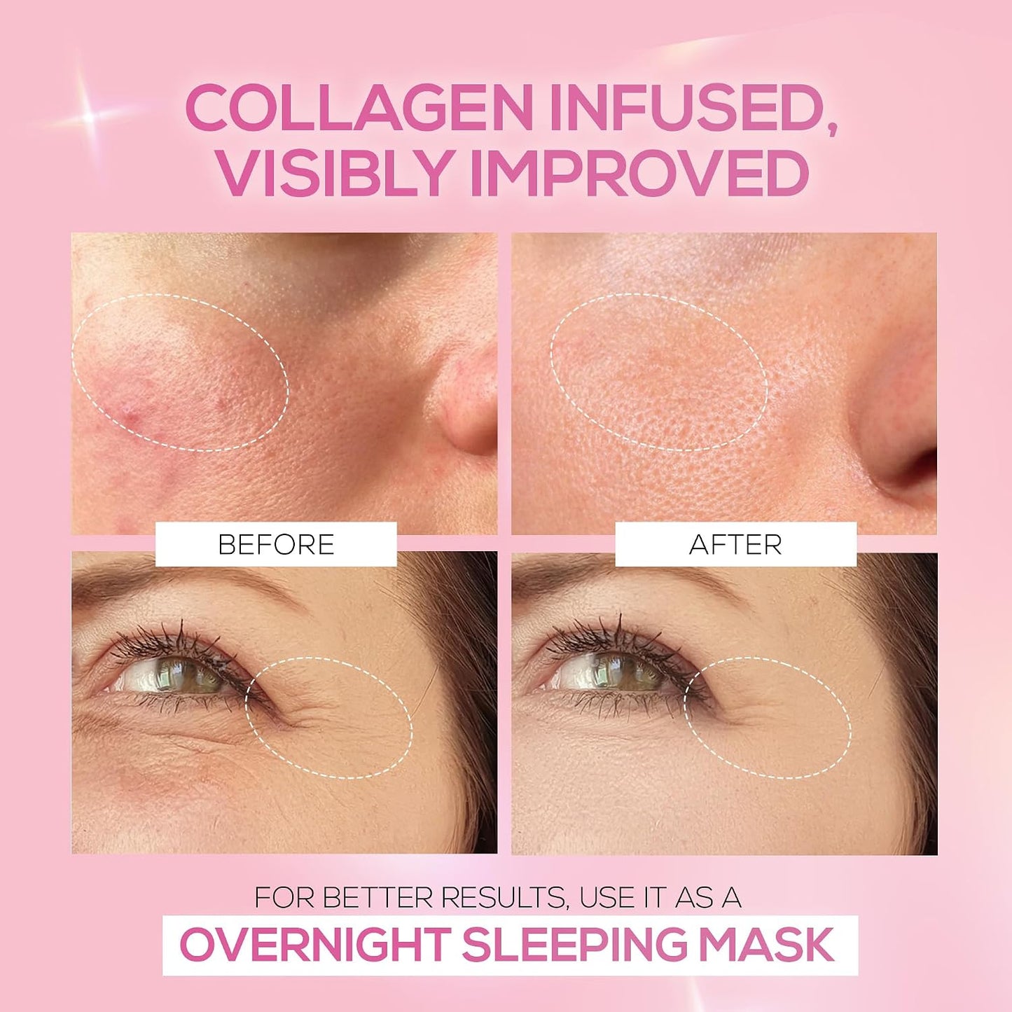 RENEE PINK THERAPY HYDROLYZED COLLAGEN JELLY CREAM - 15g