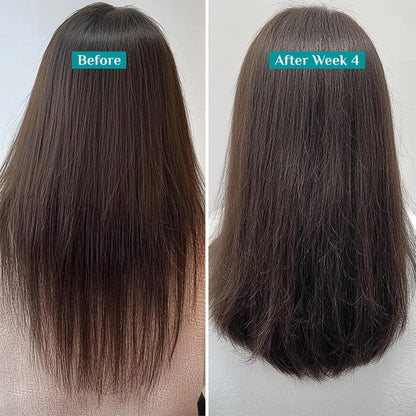 Pilgrim Redensyl & Anagain Hairfall Control Shampoo 200 MILLI_LITRE