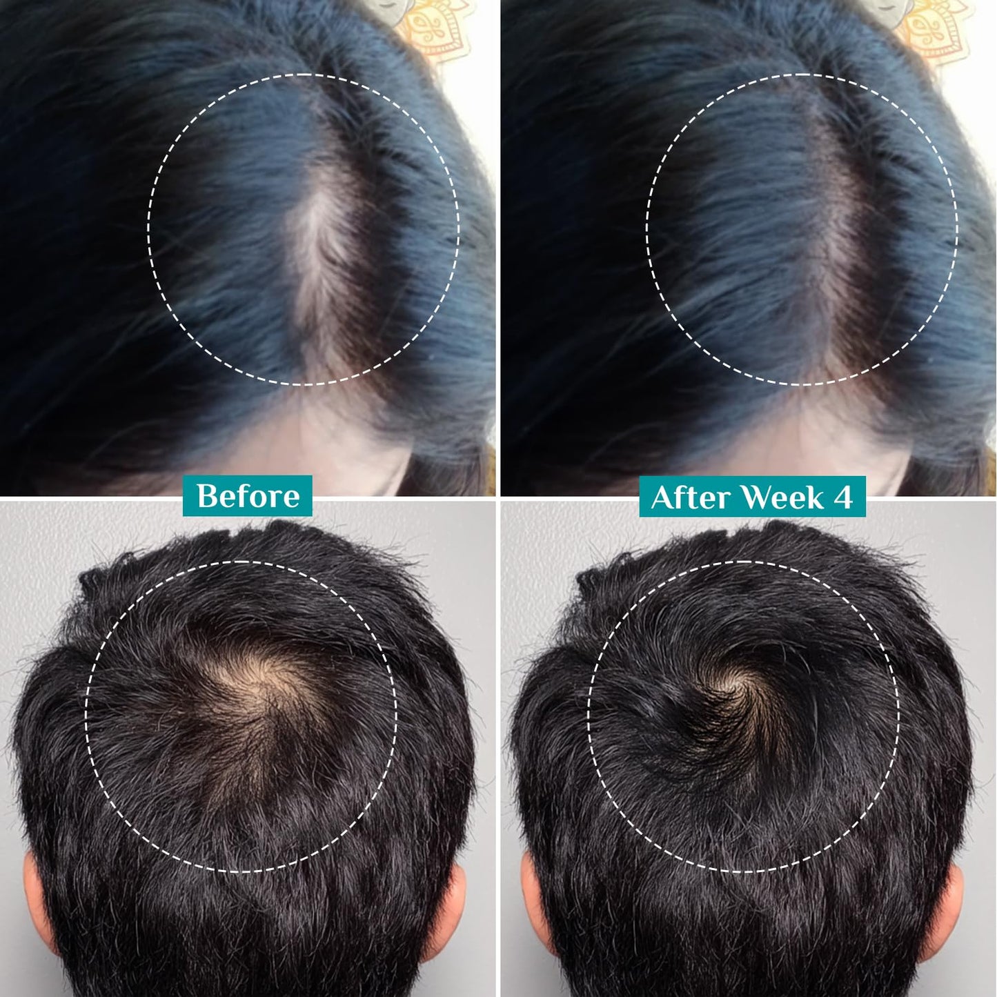 Pilgrim Redensyl & Anagain Advanced Hair Growth Serum 100 MILLI_LITRE