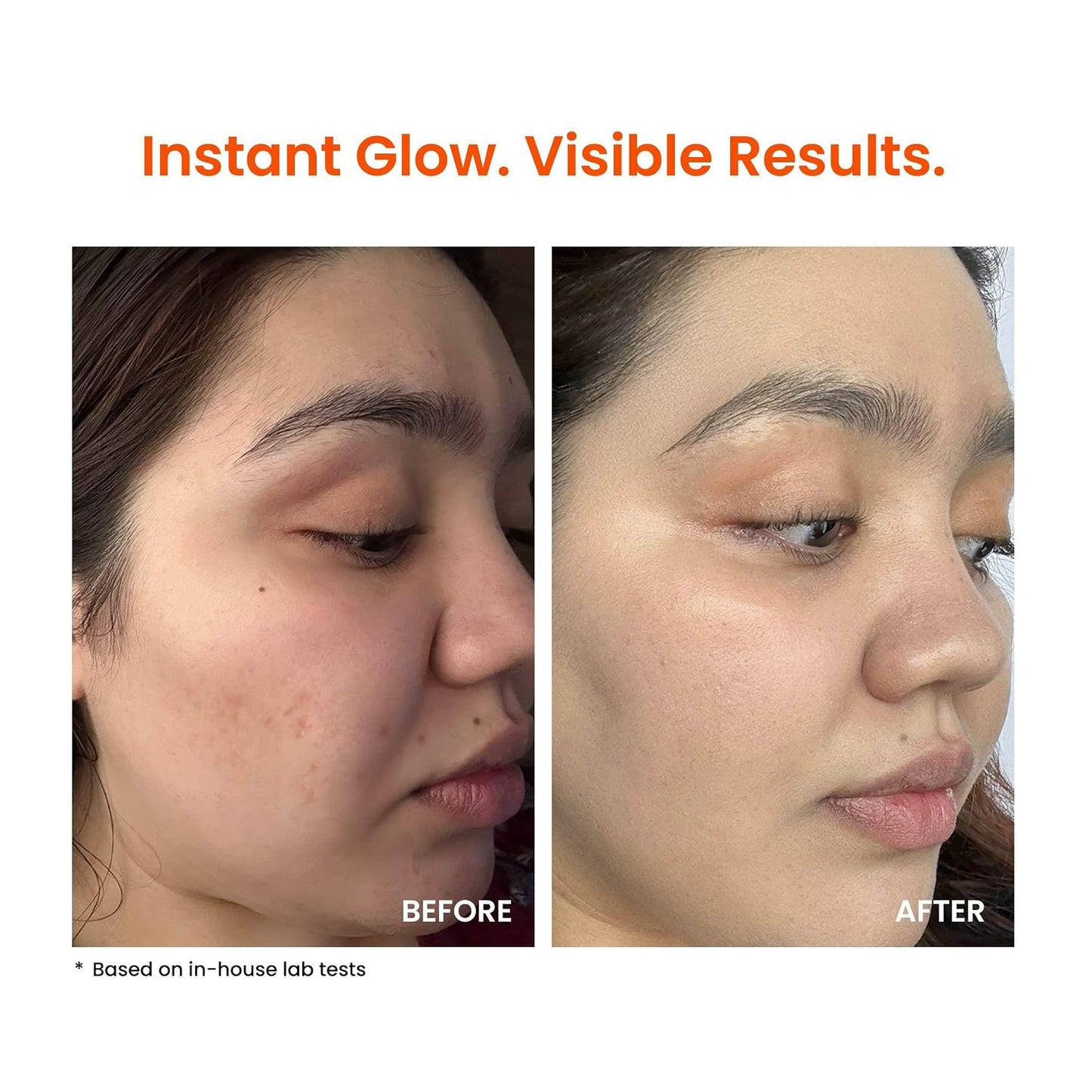 Foxtale Nano Super Glow Moisturiser 50 ml