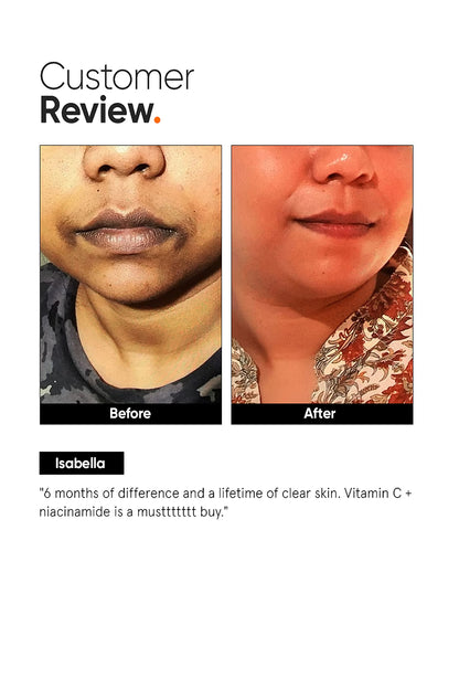 Minimalist Vitamin C+E+16% Ferulic Face Serum 20 MILLI_LITRE