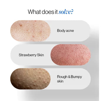 Be Bodywise 1% Salicylic Acid Body Wash