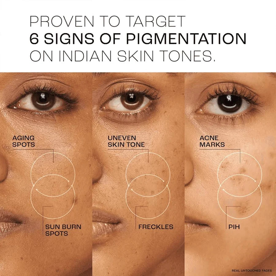 LAKME PERFECT RADIANCE PIGMENTATION TREATMENT DAY GEL CREAM